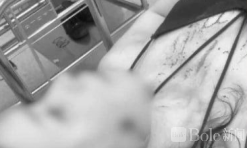 泰国普吉射击场突发意外！中国女游客遭子弹击中脸部